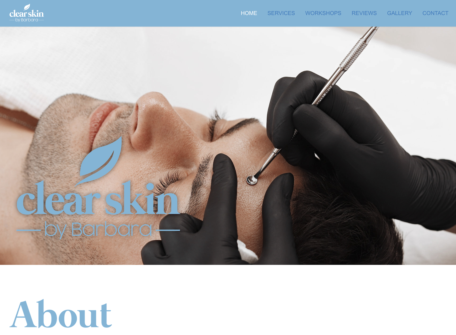 Clear Skin by Barbara Leicestershire by WA Designs